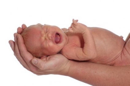 Tencuiala pentru hernia ombilicală pentru nou-născuți și alegerea lui