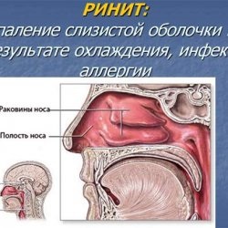 Cauzele alergiilor respiratorii - bisturiu - informație medicală și portal educațional