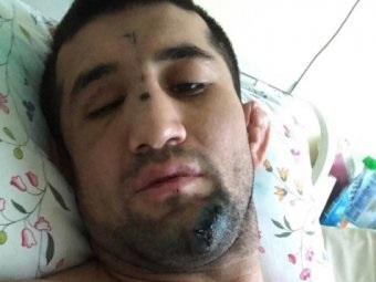 Rasul Mirzayev, a legfrissebb hírek a harcos mma elleni támadásról egy új verzió jelent meg (fotó) -