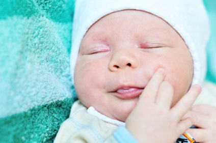 Semne de naștere în fotografiile nou-născuților, cauze ale tipurilor de pete de vârstă