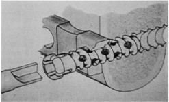 Sisteme de titan de plăci reconstructive cu șuruburi goale