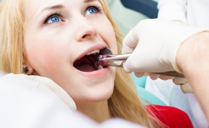 Extracția dinților, așa cum se întâmplă, refacerea clinică