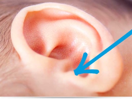 Urechile rănit