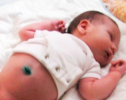 Îngrijirea ombilicului pentru nou-născut