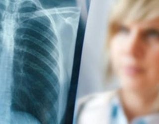 Tuberculoza focală este contagioasă la medic (tuberculoză) Este tuberculoza focală contagioasă?
