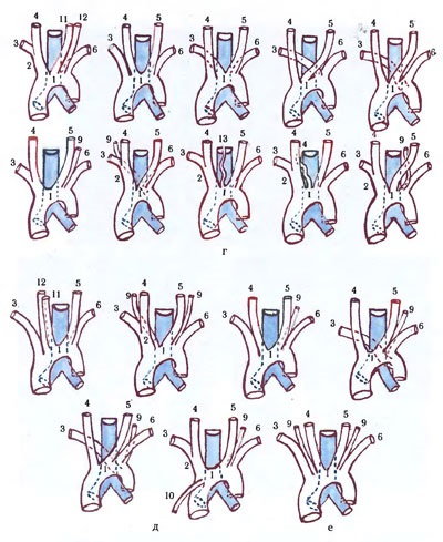 Aorta - științe medicale