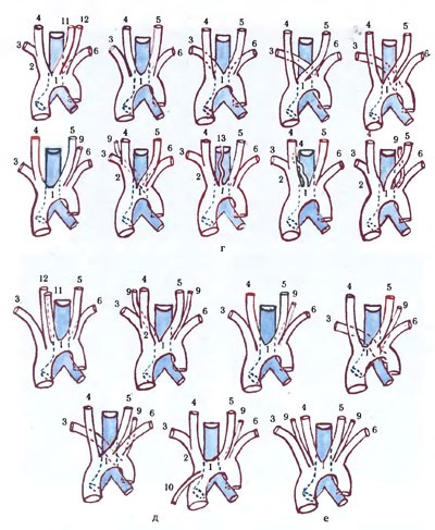 Aorta - științe medicale