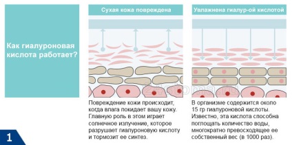 Biorevitalizarea feței este cel mai bun remediu pentru întinerirea pielii