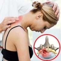 Blocarea coloanei vertebrale cu hernie este periculoasă, câte acte