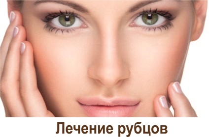 Bőrgyógyászati ​​és Scar Removal Központ