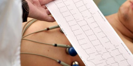 Indicatorii ECG la adulți, cu decodificare și normă