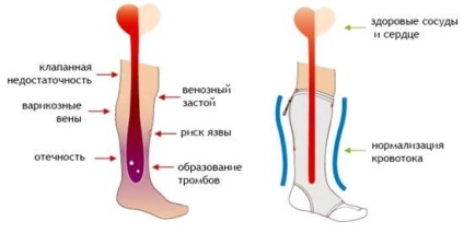 Anestezie epidurală în operațiile pe membrele inferioare