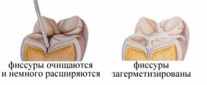 Fissurit (fissurit ф, фх) instrucțiuni privind aplicarea de etanșant