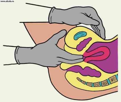 Examinarea ginecologică a enceclopediei medicale
