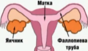 Hypofuncția ovarelor - cauze, diagnostic