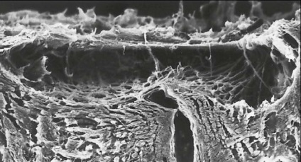 Glaucomul este centrul oftalmologic al profesorului de bazin