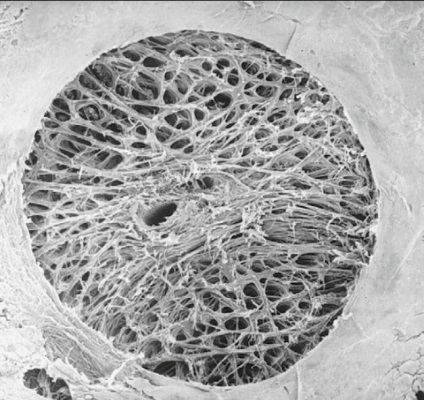 Glaucomul este centrul oftalmologic al profesorului de bazin