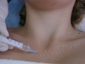 Injecție cosmetologie, clinica de cosmetică apollon