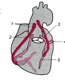 Boala cardiacă ischemică