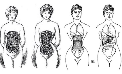 Istoria corsetei este frumos sau urât