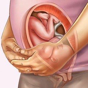 Ca creștere a dimensiunii uterului, în funcție de vârsta gestațională