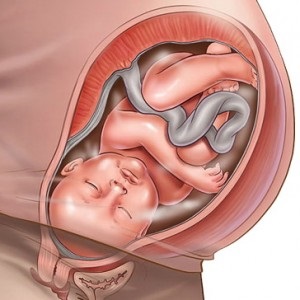 Ca creștere a dimensiunii uterului, în funcție de vârsta gestațională