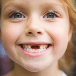 Dinți îngropați și mușcături neregulate la copii