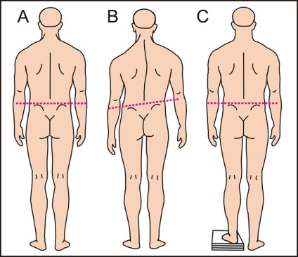 Masaj terapeutic și osteopatie - centru - osteopat