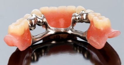 Nem hamis, hanem a fogsor főbb típusainak minőségi utánzása