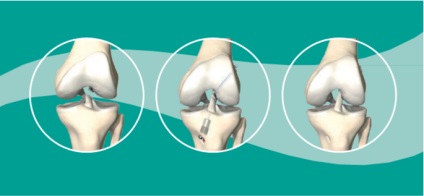 Traumatológiai és Ortopédiai Tanszék neurológiai ürükkel - FGBU Klinikai Kórház