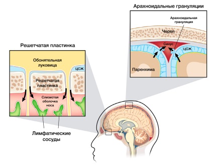 Presiune intracraniană crescută, vintauge - jurnal de familie