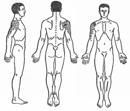 Stretching al muschilor umărului cu dureri de spate