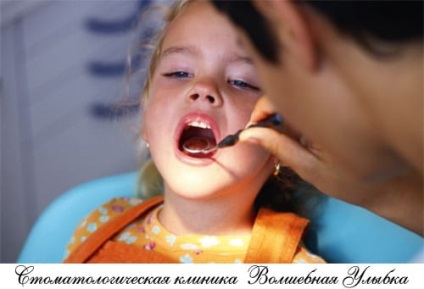 Remineralizarea dinților la copii