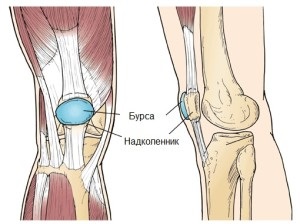 Simptomele și tratamentul bursitei articulației genunchiului