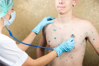 Simptome de varicelă la varicela adultă de pui