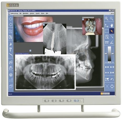 Sivision 3 - sistem de vizualizare pentru unitățile dentare