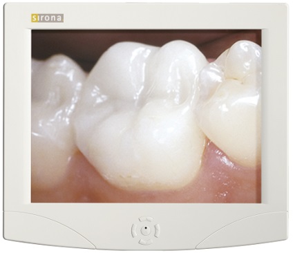 Sivision 3 - sistem de vizualizare pentru unitățile dentare