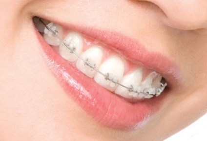 Cikkek, sajtóanyagok, esztétikai fogászat és ortodoncia