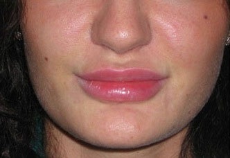 Свирки за устна подкрепление Отзиви свирки fulips, видео по заявка, подмладяване на кожата