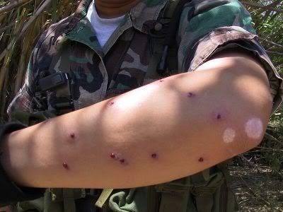 Accidentări în airsoft