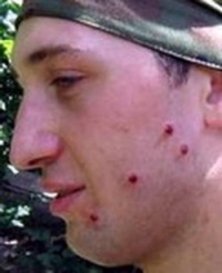 Accidentări în airsoft