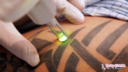 Eliminarea remediilor și metodelor pentru tatuaje