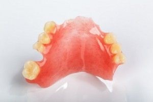 Proteze din nylon din dinți și viniluri elastice