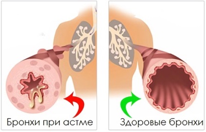 Amoxicilina cu eficacitate cistita si aplicare specifica