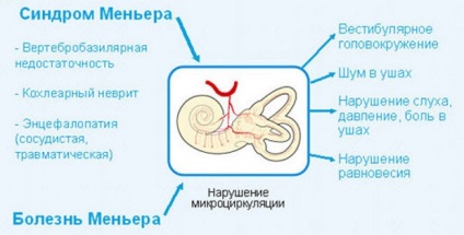 Boala simptomelor și tratamentelor mai mici, cauze posibile, metode de diagnosticare