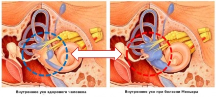 Boala simptomelor și tratamentelor mai mici, cauze posibile, metode de diagnosticare