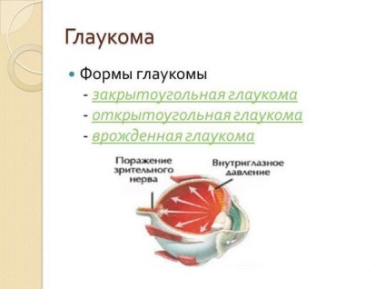 Ce este glaucomul, cauzele și consecințele acestuia, simptomele și tratamentul la adulți, debutul și