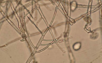 Phytophthora - totul despre ea