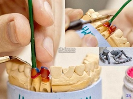 Hogyan működnek a fogak?