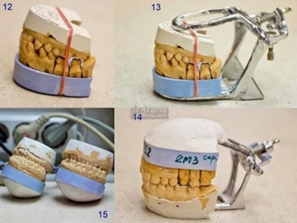 Hogyan működnek a fogak?